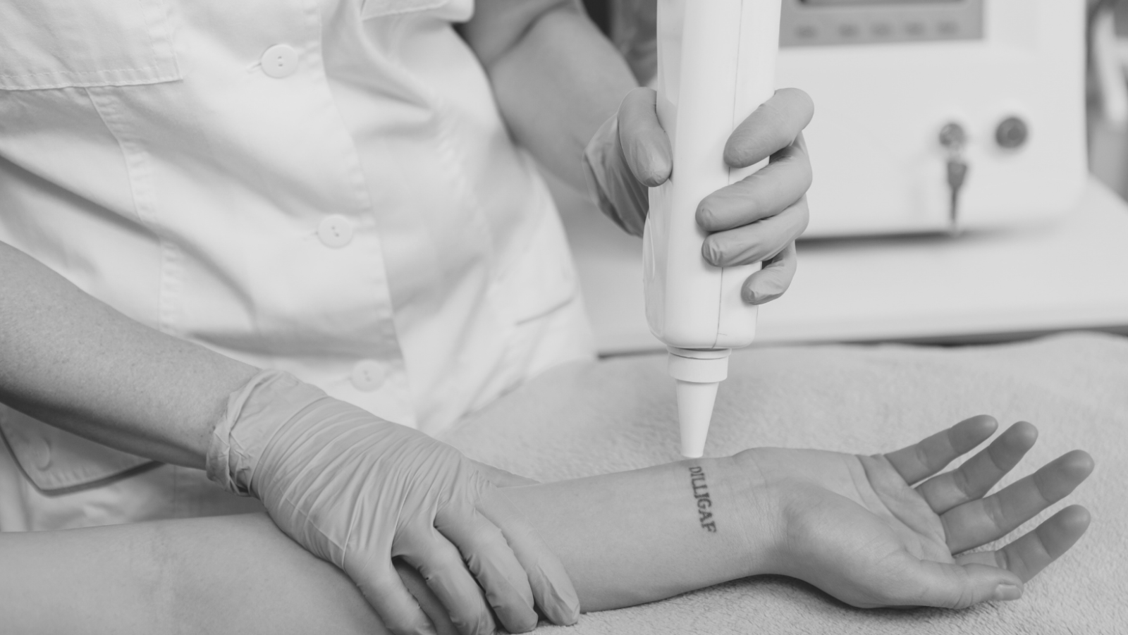 Le PicoLaser à la Clinique Crillon de Lyon : Une Avancée Majeure en Détatouage