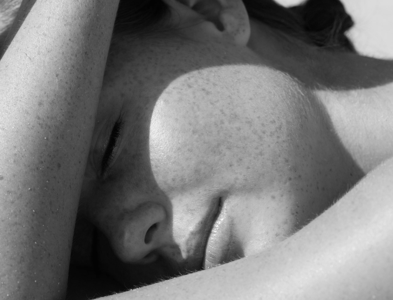 laser taches pigmentaires brunes vieillesse