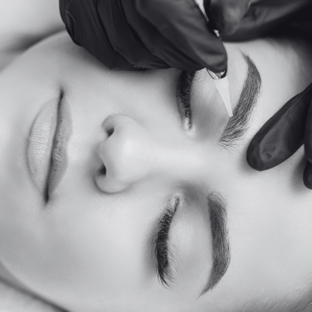 Gel effaceur sur Lyon