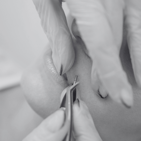 Epilation électrique 