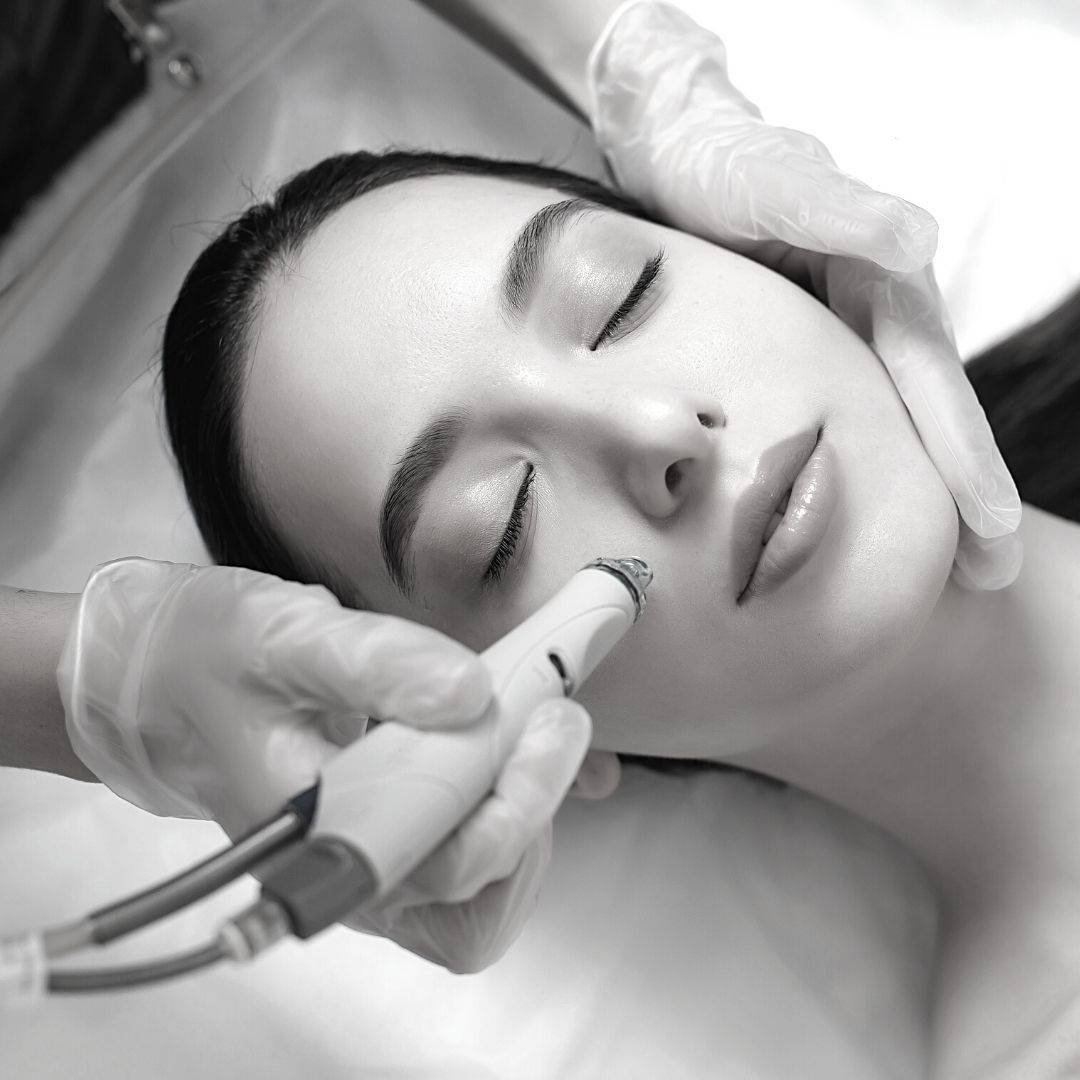 Hydrafacial, le soin ultime pour avoir une belle peau à Lyon