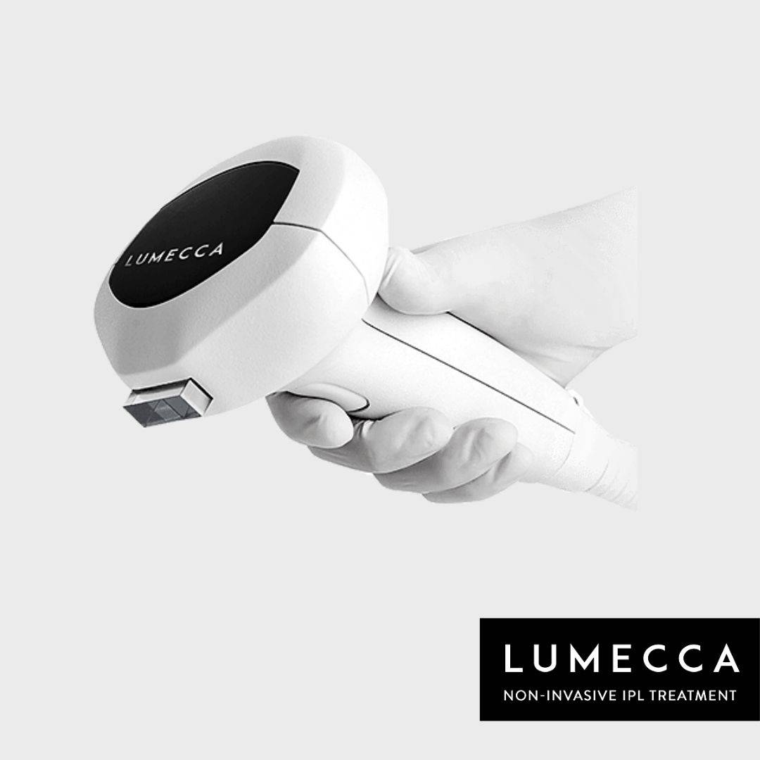 Lumecca, le traitement par IPL ou lumière intense pulsée pour traiter efficacement les lésions pigmentaires à Lyon